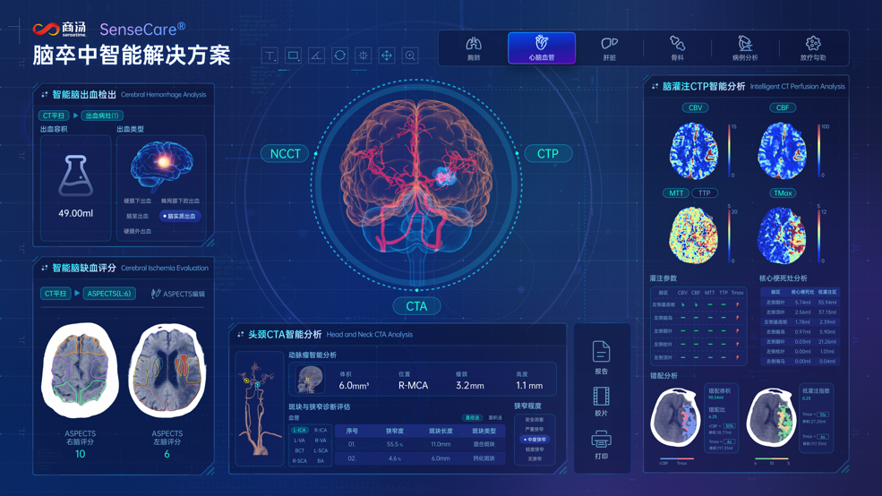 大厂AI医疗各怀心思